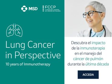 Cancer de Pulmoon en Perspectiva